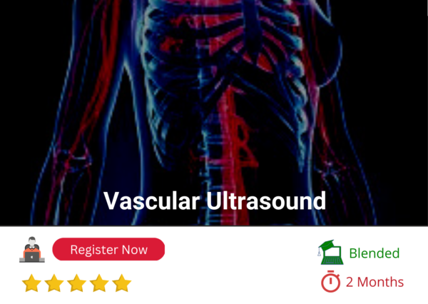 Peripheral Vascular Doppler